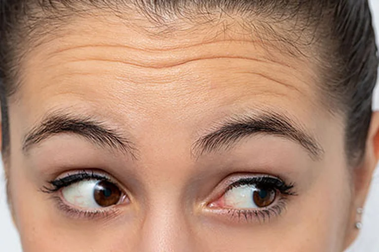 emface treatment cost uk