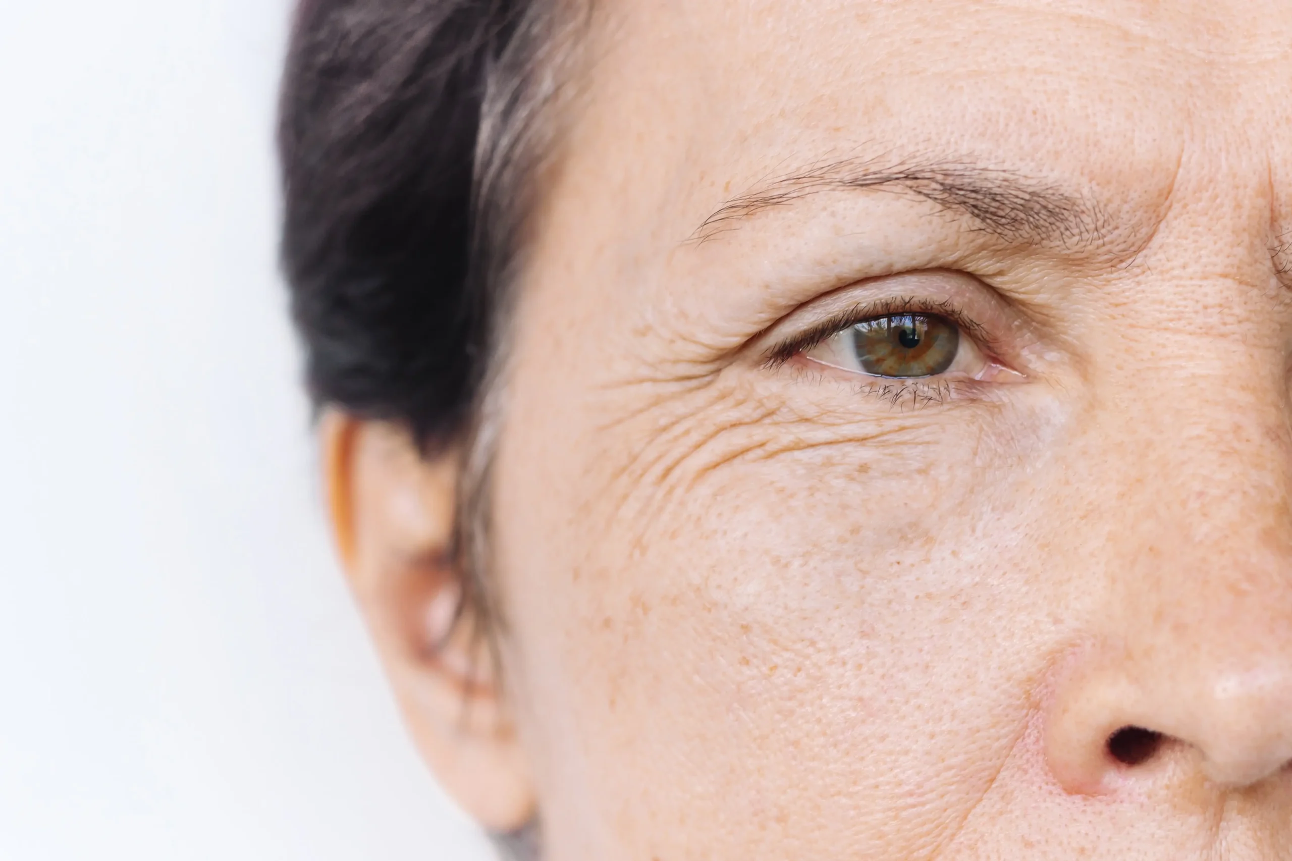 Wrinkly Skin