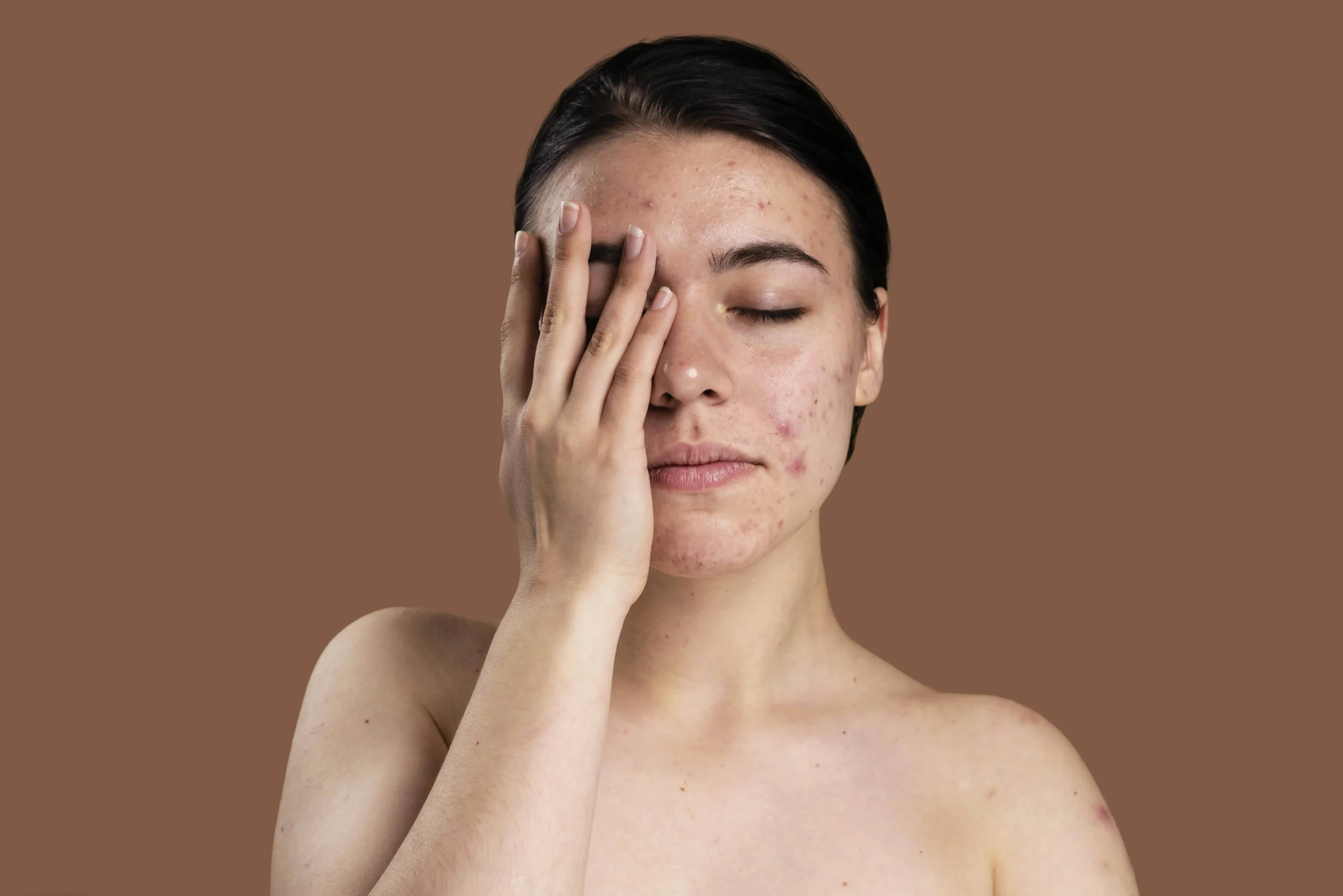 Sensitive Skin