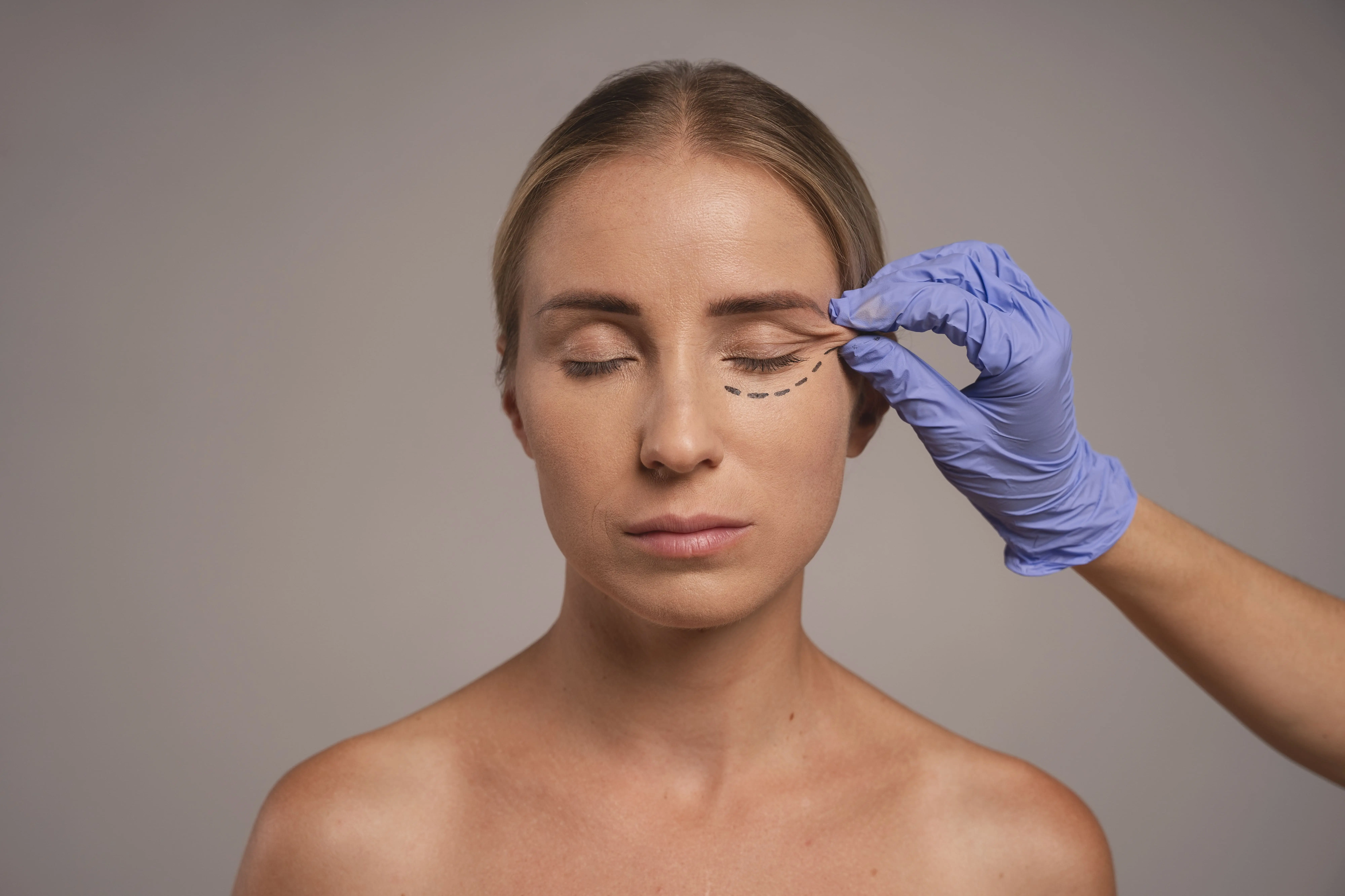 Periorbital Veins