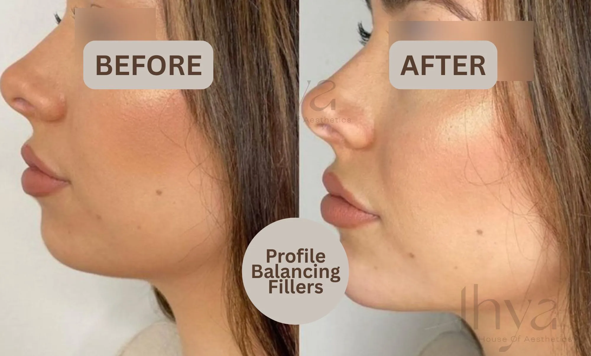 profile balancing
