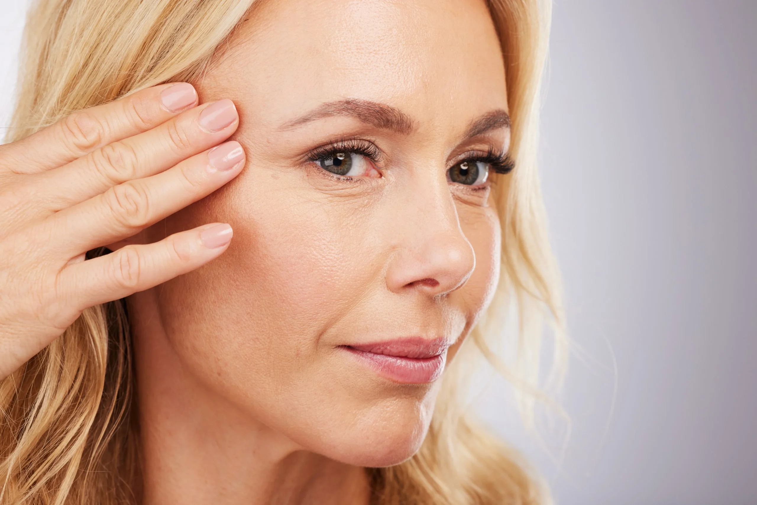 Crows feet botox