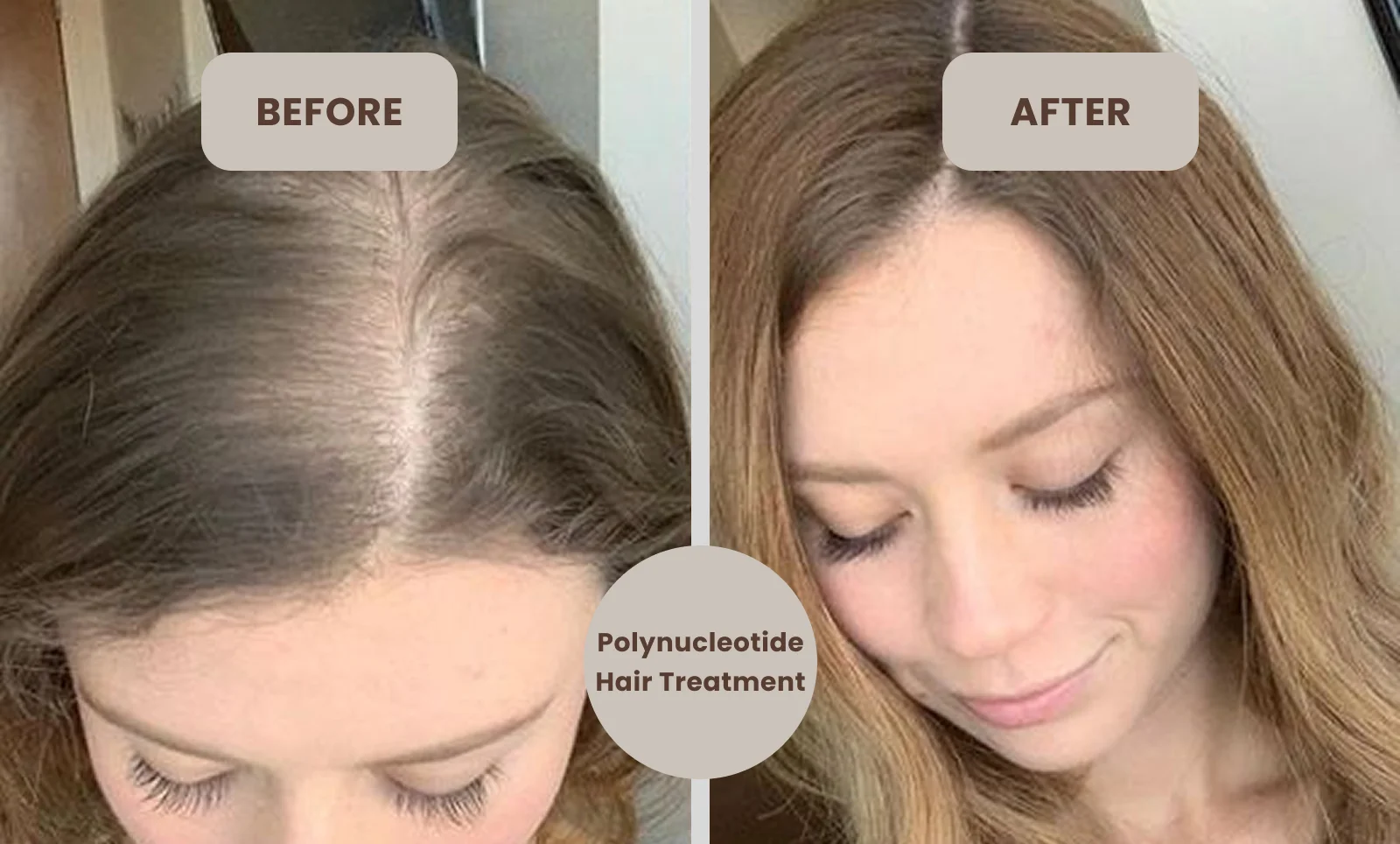 polynucleotides treatment Before and After