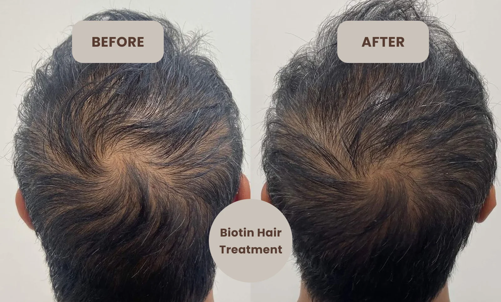 biotin treatment for hair near me