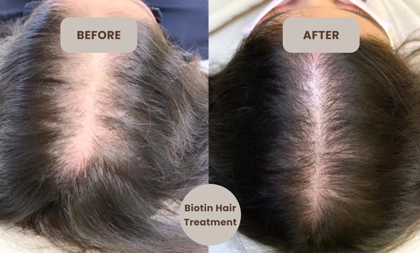 biotin hair treatment near me