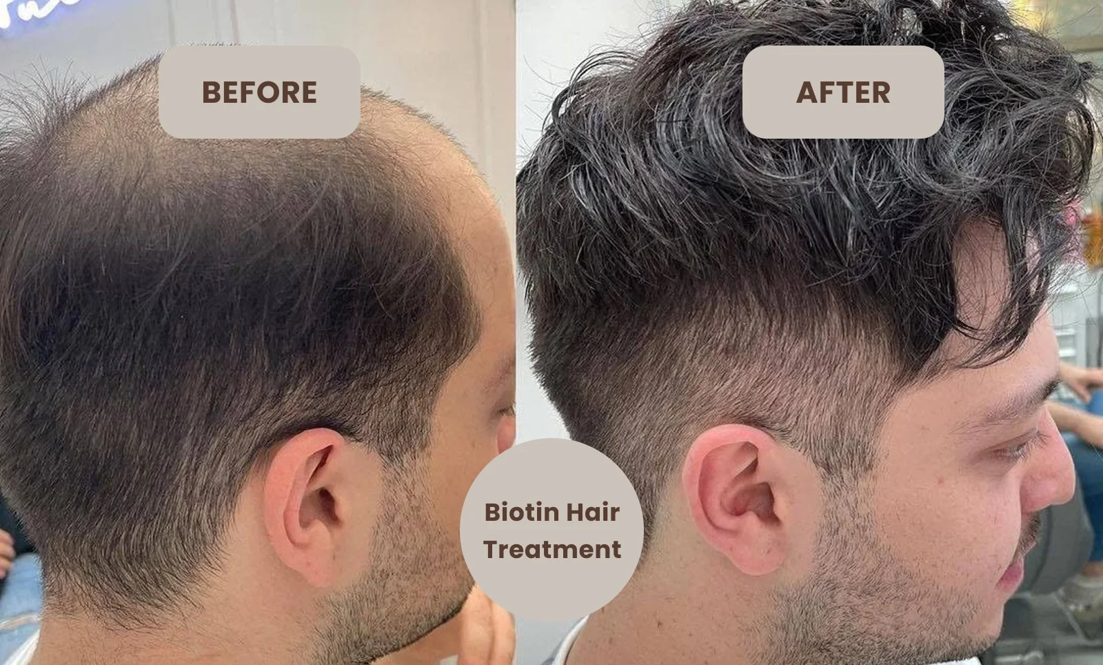 biotin thickening hair treatment