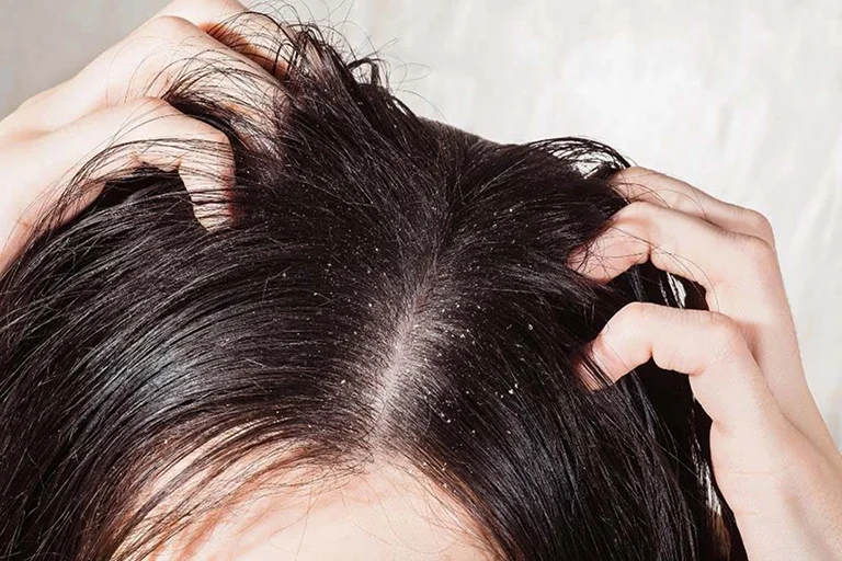 Dry Hair