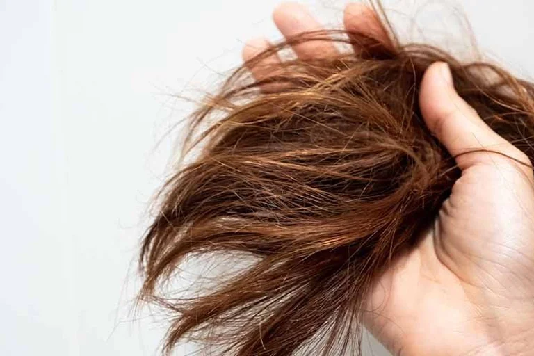laser therapy for hair loss​