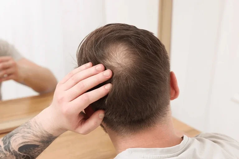 polynucleotides for weak Hair