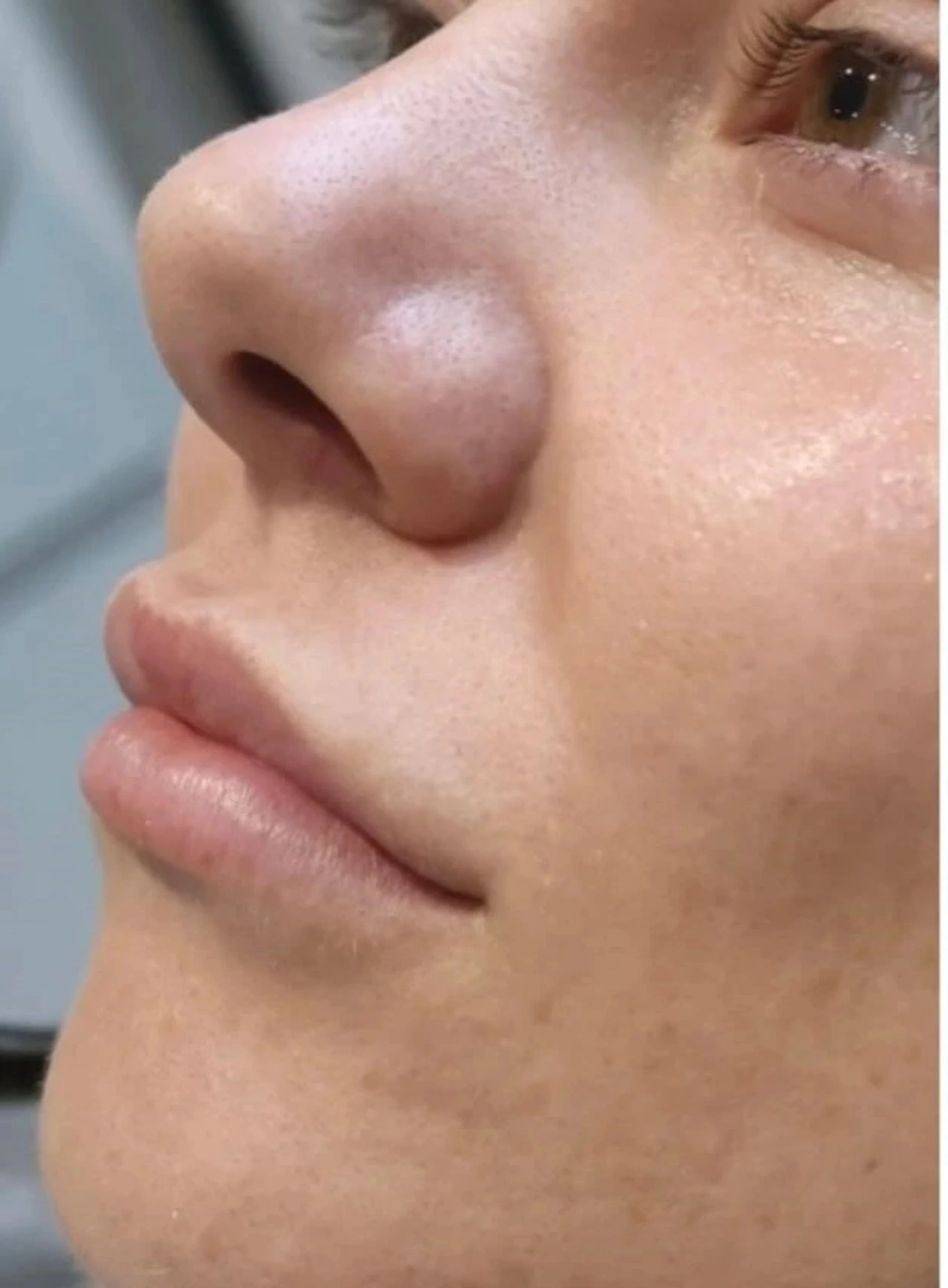 Before image