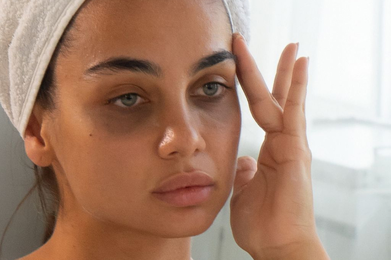 Skin Pigmentation