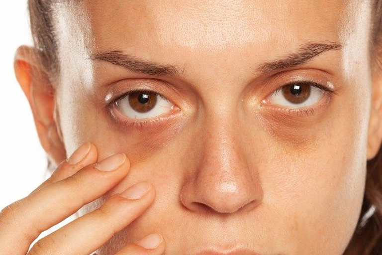 Hollow tear troughs