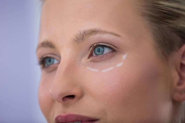 Orbital Bone Shadowing