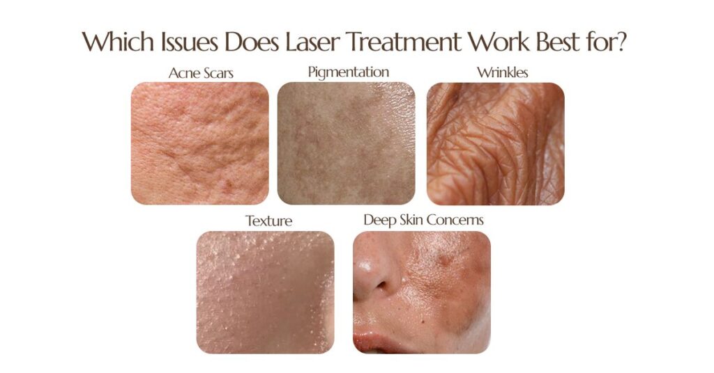 What are the skin conditions which are addressed by Skin Laser Treatment ?