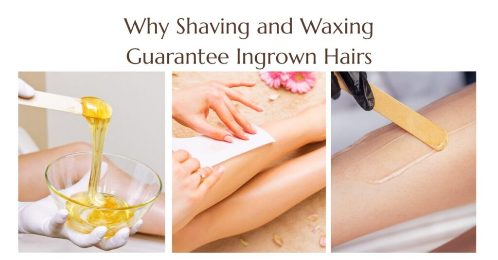 Why Shaving and Waxing Guarantee Ingrown Hairs